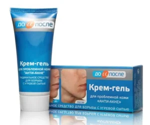 Vorher-Nachher-Anti-Akne-Creme-Gel für Problemhaut 50 ml